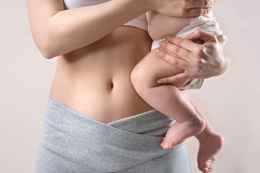 Diastasis Recti