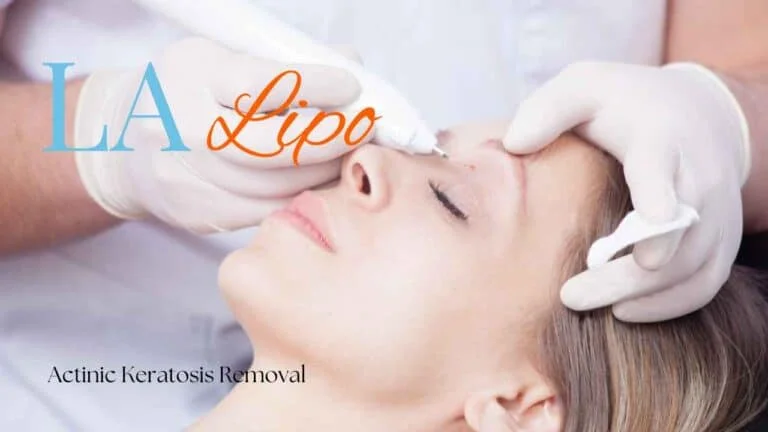 Woman receiving Actinic Keratosis Removal Treatment Wakefield