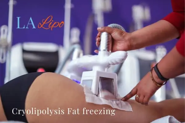 women getting fat freezing Wakefield