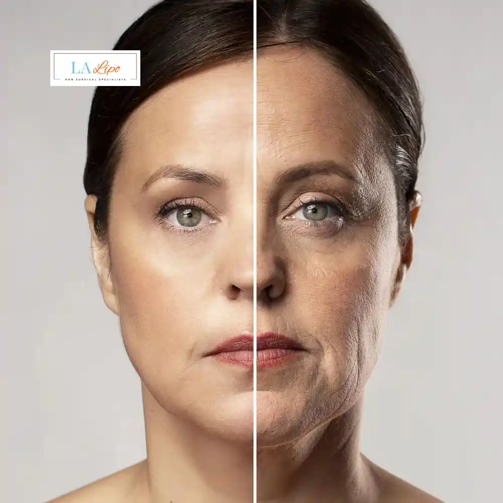 How Can You Tell If Non-Surgical Skin Tightening Is Right for You Wakefield?