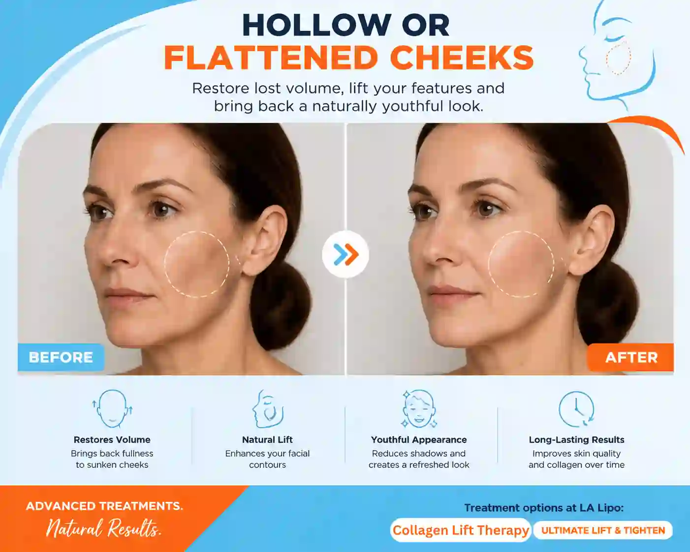 Sign #4: Hollow or Flattened Cheeks Wakefield