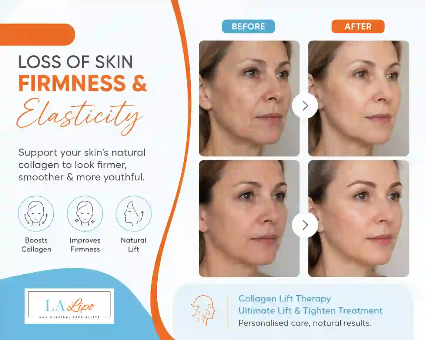 Sign #7: Loss of Skin Firmness and Elasticity Wakefield